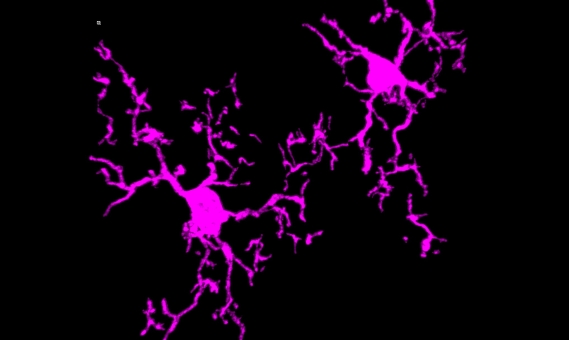 visuel noir et fushia